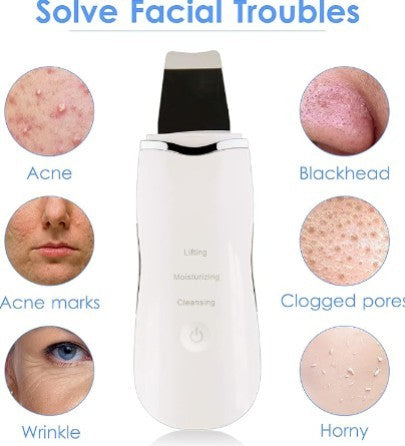 3-in-1 Ultrasonic Facial Skin Scrubber
